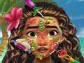 खेल Moana Skin Doctor